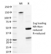 SDS-PAGE Analysis of Purified, BSA-Free Neurofilament Antibody (clone NR-4). Confirmation of Integrity and Purity of the Antibody.