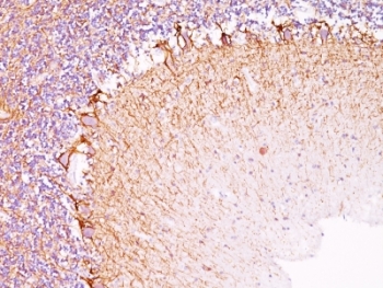IHC: Formalin-fixed, paraffin-embedded human cerebellum stained with Neurofilament antibody (NR-4).~