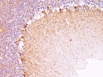 IHC: Formalin-fixed, paraffin-embedded human cerebellum stained with Neurofilament antibody (NR-4).