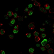 Immunofluorescent staining of permeabilized human HEK293 cells with Neurofilament antibody (clone NR-4, green) and Phalloidin (red).