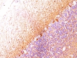 IHC: Formalin-fixed, paraffin-embedded cerebellum stained with Neurofilament antibody (SPM204).