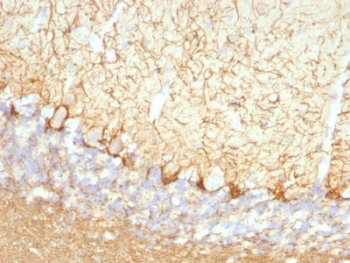 IHC: Formalin-fixed, paraffin-embedded rat cerebellum stained with Neurofilament antibody (clone NFL/736).~