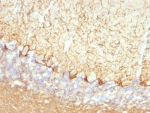 IHC: Formalin-fixed, paraffin-embedded rat cerebellum stained with Neurofilament antibody (clone NFL/736).