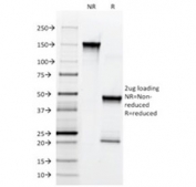 SDS-PAGE analysis of purified, BSA-free NGF Receptor antibody (clone SPM299) as confirmation of integrity and purity.