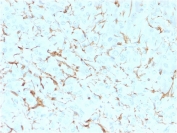 IHC analysis of formalin-fixed, paraffin-embedded human adrenal gland stained with NGF Receptor antibody (clone SPM299).