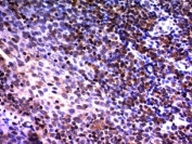 IHC analysis of formalin-fixed, paraffin-embedded human tonsil stained with NuMA antibody (clone A73-B/D12).