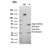 SDS-PAGE analysis of purified, BSA-free NuMA antibody (clone SPM300) as confirmation of integrity and purity.