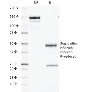 SDS-PAGE Analysis of Purified, BSA-Free ODC Antibody (clone ODC1/486). Confirmation of Integrity and Purity of the Antibody.