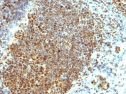 IHC: Formalin-fixed, paraffin-embedded human tonsil stained with PCNA antibody (clone PCNA/694).