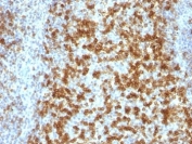 IHC: Formalin-fixed, paraffin-embedded human tonsil stained with PD-1 antibody (PDCD1/922).