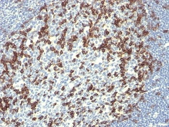IHC: Formalin-fixed, paraffin-embedded human tonsil stained with PD-1 antibody (PDCD1/922).~