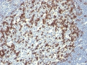 IHC: Formalin-fixed, paraffin-embedded human tonsil stained with PD-1 antibody (PDCD1/922).