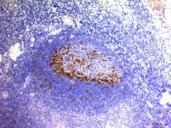 IHC: Formalin-fixed, paraffin-embedded human tonsil stained with PD1 antibody (clone SPM597).