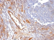 IHC: Formalin-fixed, paraffin-embedded human tonsil stained with CD31 antibody (C31.10).