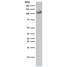 Western blot testing of human Jurkat cell lysate with CD31 antibody (clone C31.10). Predicted size: 83-130 kDa depending on level of glycosylation.