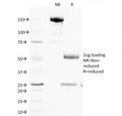 SDS-PAGE analysis of purified, BSA-free Cytochrome C antibody (clone SPM389) as confirmation of integrity and purity.