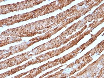 IHC staining of FFPE human heart with Cytochrome C antibody (clone CTC05). HIER: