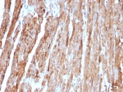 IHC: Formalin-fixed, paraffin-embedded human heart stained with Cytochrome C antibody (CYCS/1010).