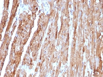 IHC: Formalin-fixed, paraffin-embedded human heart stained with Cytochrome C antibody (CYCS/1010).~