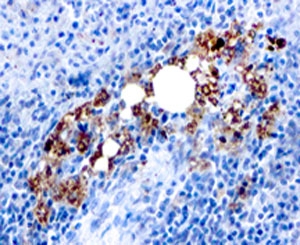 IHC: Formalin-fixed, paraffin-embedded human spleen stained with TRAcP antibody (ACP5/1070)~