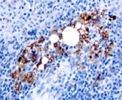 IHC: Formalin-fixed, paraffin-embedded human spleen stained with TRAcP antibody (ACP5/1070)