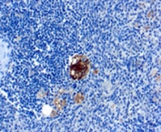 IHC: Formalin-fixed, paraffin-embedded human spleen stained with TRAcP antibody (clone SPM601).