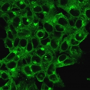 Immunofluorescent staining of permeabilized human HeLa cells with Beta-2 Microglobulin antibody (clone B2M/1118).