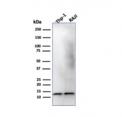 Western blot testing of human THP-1 and Raji cell lysate with Beta-2 Microglobulin antibody. Expected molecular weight: 12-14 kDa.