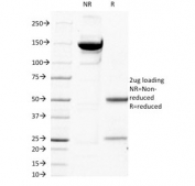 SDS-PAGE analysis of purified, BSA-free Beta-2 Microglobulin antibody (clone B2M/1118) as confirmation of integrity and purity.