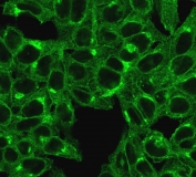 Immunofluorescent staining of permeabilized human HeLa cells with B2M antibody (clone SPM617).