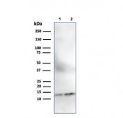 Western blot testing of human 1) ThP-1 and 2) Raji cell lysate with B2M antibody (clone SPM617). Expected molecular weight: 12-14 kDa.