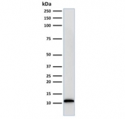 Western blot testing of human Raji cell lysate with Beta-2 Microglobulin antibody (clone BBM.1). Expected molecular weight: 12-14 kDa.