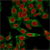 Immunofluorescent staining of permeabilized human HeLa cells with Beta-2 Microglobulin antibody (green, clone BBM.1) and Reddot nuclear stain (red).