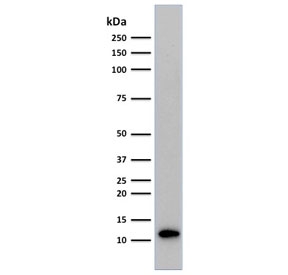 Western blot testing of human Raji cell lysate with Beta-2 Microglobulin antibody (clone C21.48A1). Expected molecular weight: 12-14 kDa.~