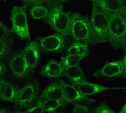 Immunofluorescent staining of permeabilized human HeLa cells with Beta-2 Microglobulin antibody (clone C21.48A1).