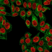 Immunofluorescent staining of human HeLa cells with Beta-2 Microglobulin antibody (green, clone B2M/961) and Reddot nuclear stain (red).