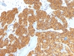 IHC: Formalin-fixed, paraffin-embedded human parathyroid stained with Parathyroid Hormone antibody (PTH/911).