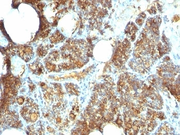 IHC: Formalin-fixed, paraffin-embedded human parathyroid stained with Parathyroid Hormone antibody (clone PTH/1173).~