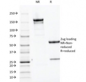 SDS-PAGE Analysis of Purified, BSA-Free PTH Antibody (clone PTH/1174). Confirmation of Integrity and Purity of the Antibody.