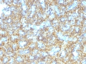 IHC: Formalin-fixed, paraffin-embedded human parathyroid stained with PTH antibody (PTH/1174).