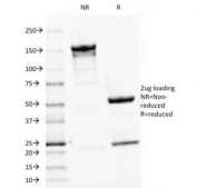 SDS-PAGE Analysis of Purified, BSA-Free PTH Antibody (clone PTH/1175). Confirmation of Integrity and Purity of the Antibody.