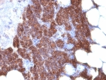 IHC: Formalin-fixed, paraffin-embedded human parathyroid stained with PTH antibody (3H9 + PTH/1175).