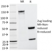 SDS-PAGE Analysis of Purified, BSA-Free Cyclin D1 Antibody (clone CCND1/809). Confirmation of Integrity and Purity of the Antibody.