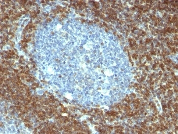 IHC: Formalin-fixed, paraffin-embedded human tonsil stained with Bcl-2 antibody (BCL2/796).~