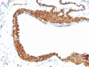 IHC: Formalin-fixed, paraffin-embedded rat lung stained with ACTA2 antibody cocktail (clone 1A4 + ACTA2/791).