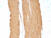 IHC: Formalin-fixed, paraffin-embedded rat stomach stained with ACTA2 antibody cocktail (clone 1A4 + ACTA2/791).