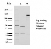 SDS-PAGE analysis of purified, BSA-free ACTA2 antibody cocktail antibody (clone 1A4 + ACTA2/791) as confirmation of integrity and purity.