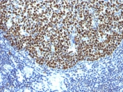 IHC testing of formalin-fixed, paraffin-embedded human tonsil stained with anti-Bcl6 antibody (clone SPM602).