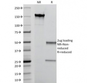SDS-PAGE Analysis of Purified, BSA-Free MRP14 Antibody (clone MAC387). Confirmation of Integrity and Purity of the Antibody.
