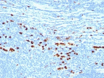 IHC analysis of formalin-fixed, paraffin-embedded human tonsil stained with MRP14 protein antibody (clone MAC387).~